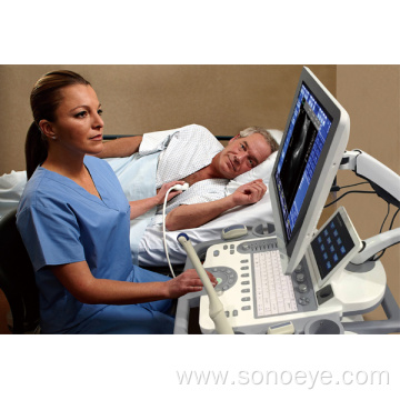 Trolley Type Ultrasound Scanner